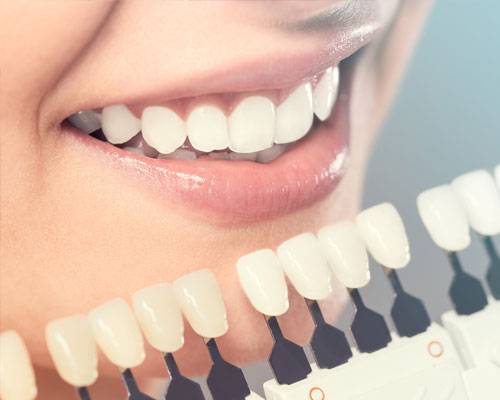 Cosmetic dentistry