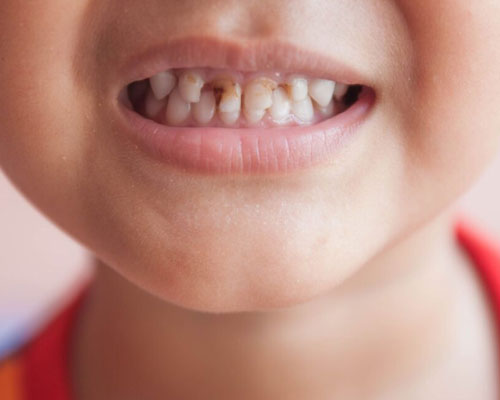 Paediatric dentistry